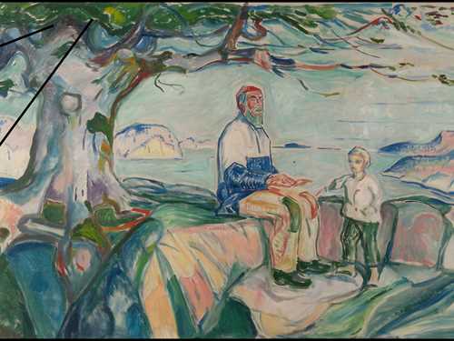 Bildeutsnittene viser hvordan fernissen er brutt ned, gulnet og krakelert på maleriet Historien fra 1914. Krakeleringene går gjennom hele fernisslaget. Det utgjør imidlertid ingen umiddelbar risiko for fargelaget under, og det er ikke planlagt noen rensing av maleriet.