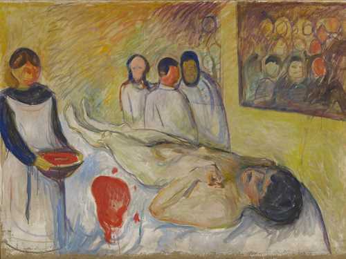 A man on the operation table, on his back, with the head towards the lower right corner. On the left hand side you see a nurse and in the back of the painting you see a group of three doctors.